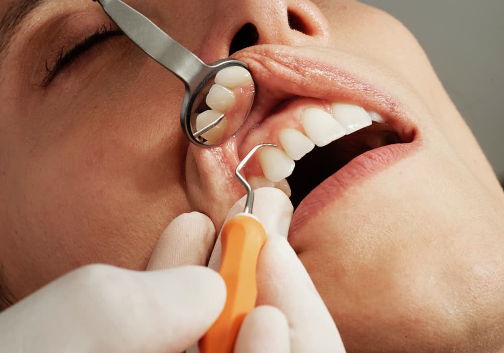 ¿Tiene cura la periodontitis? Hablamos de ella, de sus causas, síntomas, prevención y tratamiento.